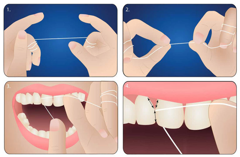 How To Floss Your Teeth Complete Guide Family Cosmetic Dentist In 