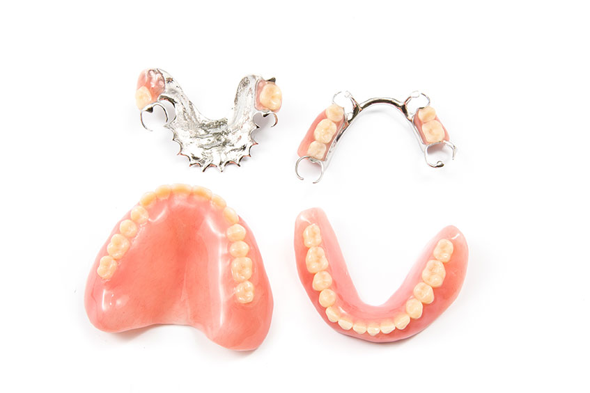 Different types of removable dentures