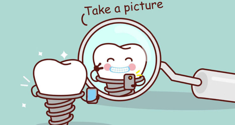 dental implant fun image