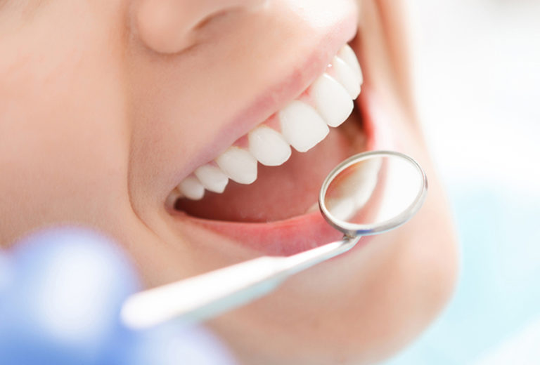Different Teeth Whitening Costs (2020 Update) Elegantdentcare Blog
